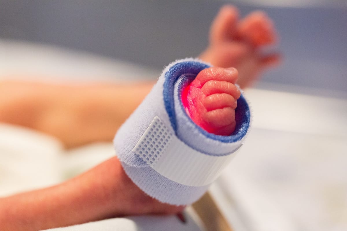 Bebes prematuros: ¿a qué edad caminan?