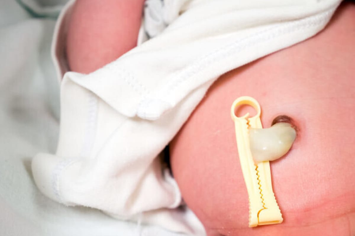 ¿Cuánto tarda en caerse el cordón umbilical?